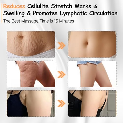 Lymphatic Drainage Massager, 35-Speed 4-in-1 Portable Lymphatic Drainage Tool Body Sculpting Machine Suitable for Abdomen, Arms, Back & Legs, Heat & Vibration Promotes Circulation sculptigue(white)