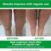 TESMED Manual Cellulite Massager Made in Italy with Converging Roller Technology